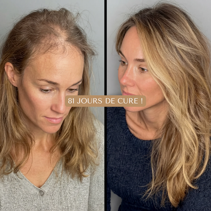 HUILE CAPILAIRE NATURELLE