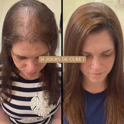 HUILE CAPILAIRE NATURELLE